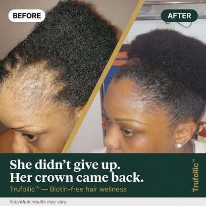 Trufollic - Hair Wellness Formula